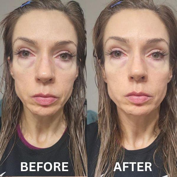 Anti Aging Eye Patches