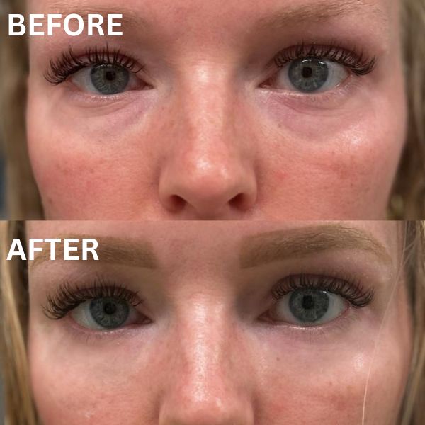 Anti Aging Eye Patches