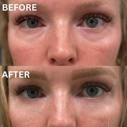 Anti Aging Eye Patches