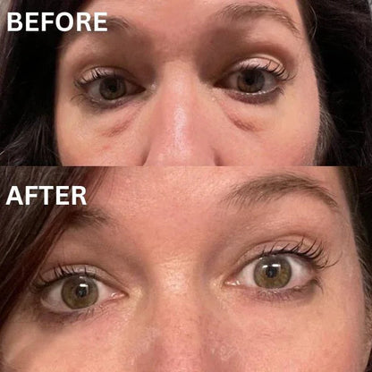 Anti Aging Eye Patches