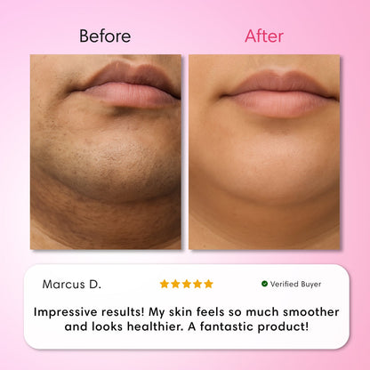 Snatched Hair Removal Cream