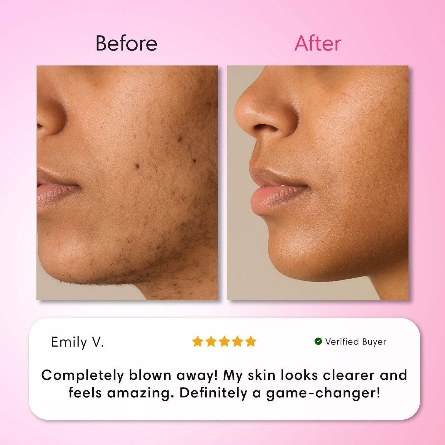 Snatched Hair Removal Cream