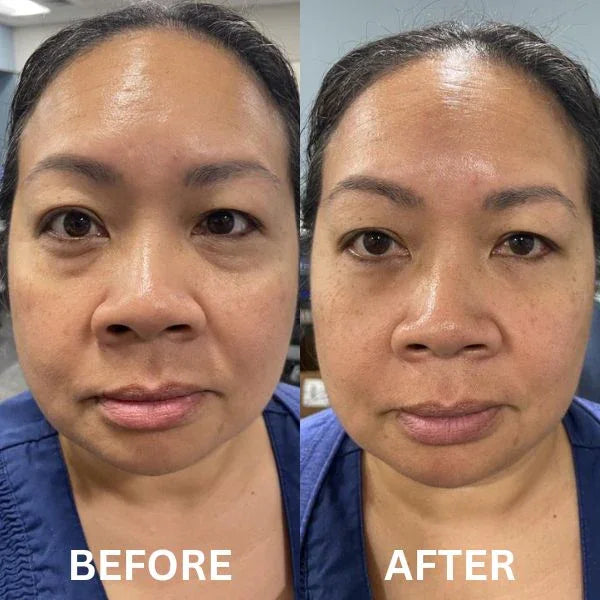 Anti Aging Eye Patches