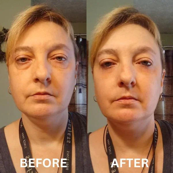 Anti Aging Eye Patches