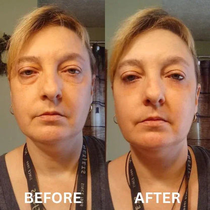 Anti Aging Eye Patches
