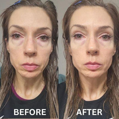 Anti Aging Eye Patches