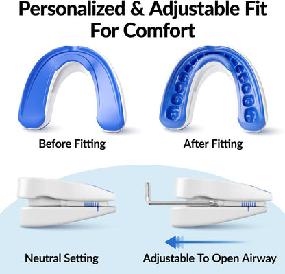Snatched Anti-Snoring Mouthpiece