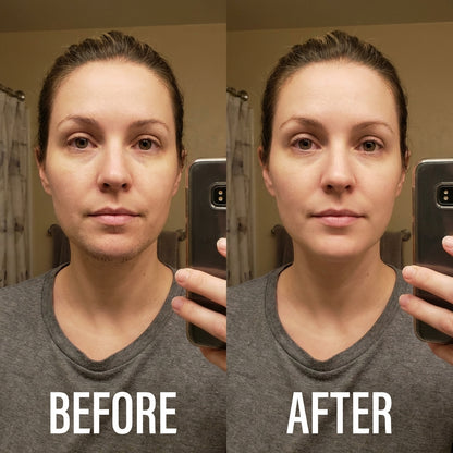 Snatched PCOS Hair Removal Cream