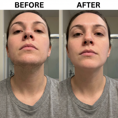 Snatched PCOS Hair Removal Cream