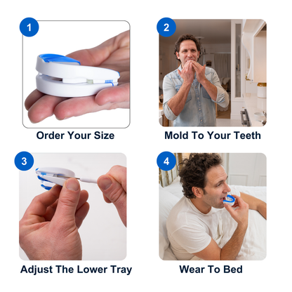 Snatched Anti-Snoring Mouthpiece